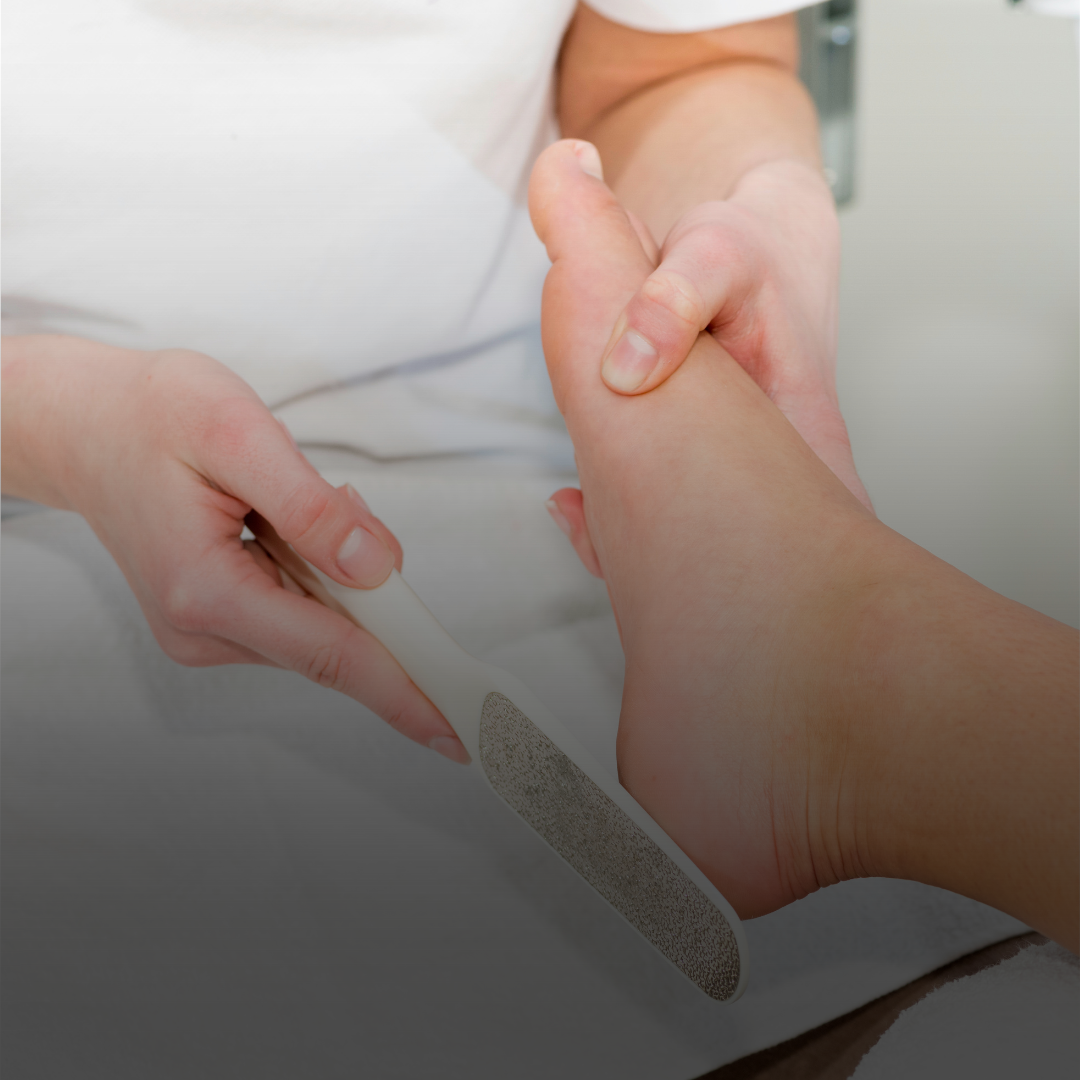 Foot Softener (Peel)- excludes pedicure